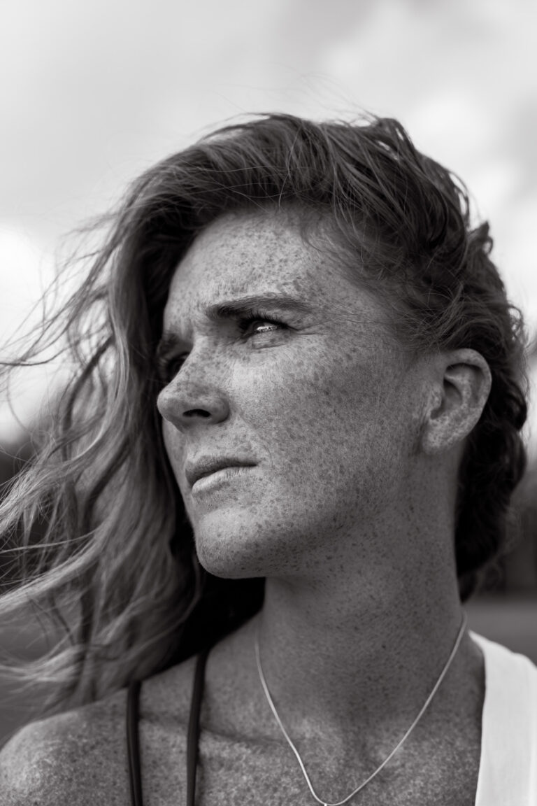 A freckled young woman poses for a portrait